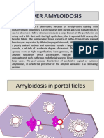 6b-Liver Amyloidosis