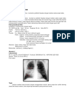 Tutorial 5 Pneumonia