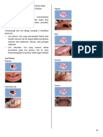 Manifestasi Oral Infeksi