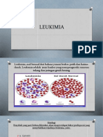 LEUKIMIA