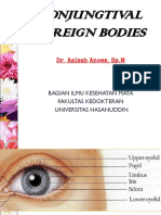 Dr. Azizah CONJUNGTIVAL FOREIGN BODIES & Subconjunctiva Hoemorrhage