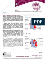 Persistent Ductus Arteriosus Factsheet