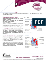 Ventricular Septal Defect VSD Factsheet