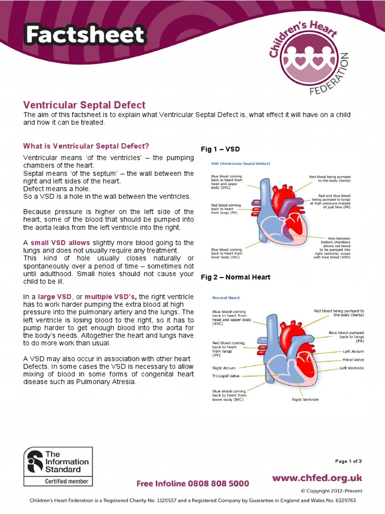 Understanding Ventricular Septal Defect | PDF | Ventricle (Heart ...