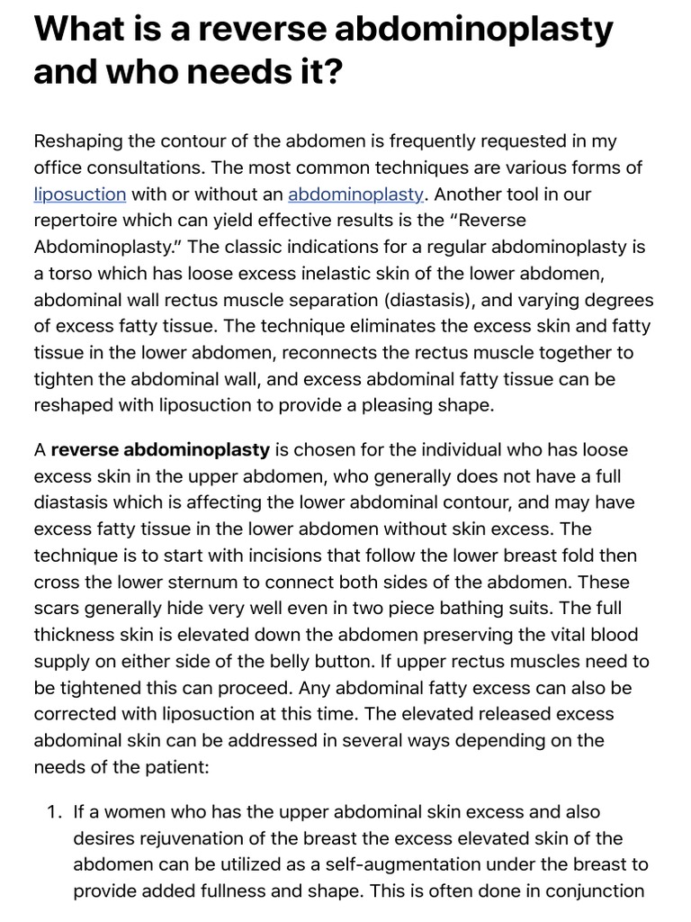Reverse Abdominoplasty A Unique Technique for Addressing Loose Upper
