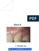 Melanotic Macule Oral