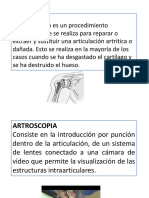 Artroplastia, artroscopia y ortopedia