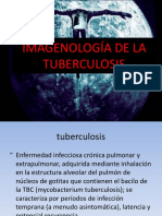 RadioLogia de Tuberculosis