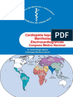 Cardiopatia Isquemica y Sus Manifestaciones Electrocardiograficas. CMN 2014