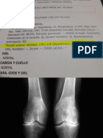 Hipertension y Analgesia