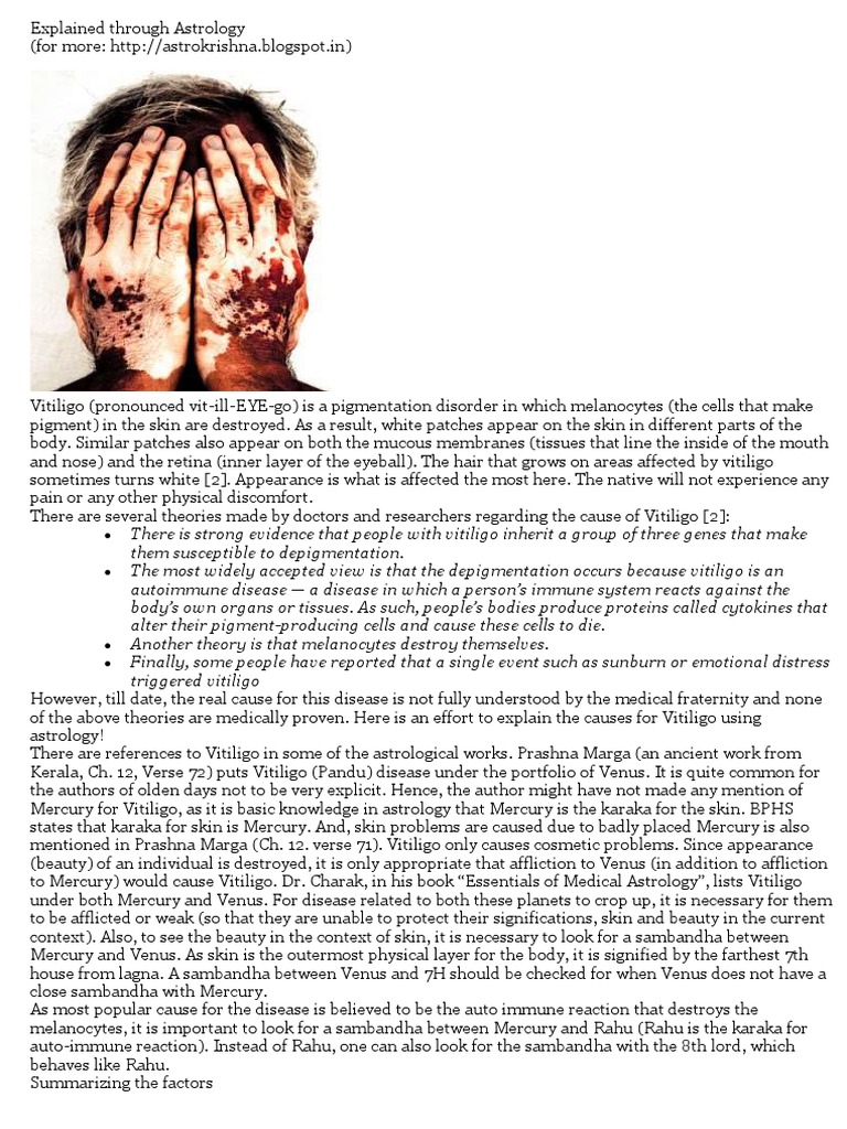 Vitiligo (Leucoderma) Krishnamurthy S Medium PDF Technical