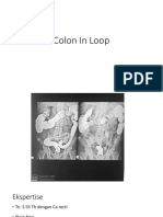 Colon in Loop