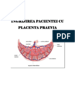 Placenta Praevia Licenta