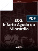 Resumo Infarto Agudo do Miocardio
