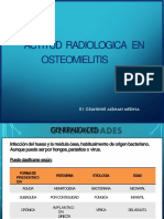 Osteomielitis Radiologia