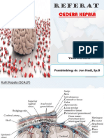 Referat Cedera Kepala