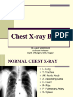 Chest X Ray Basics