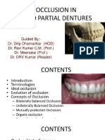 occlusion-in-fixed-partial-denture