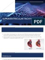 Supraventricular Tachycardia