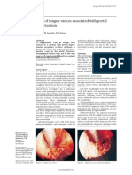 Base Tongue Varices PDF