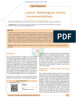 Chest_tuberculosis_Radiological_review_and_imaging.pdf