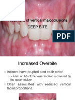 Deepbite