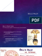 Bells Palsy