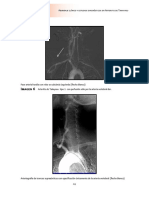 AbordajeclínicoyestudiosdiagnósticosenArteritisdeTakayasuAbordajeclínicoyestudiosdiagnósticosen - PDF Pagina 48