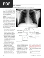 Chest X-Ray Positioning Techniques | PDF | Thorax | Medical Specialties