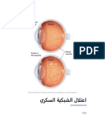 اعتلال الشبكية السكري