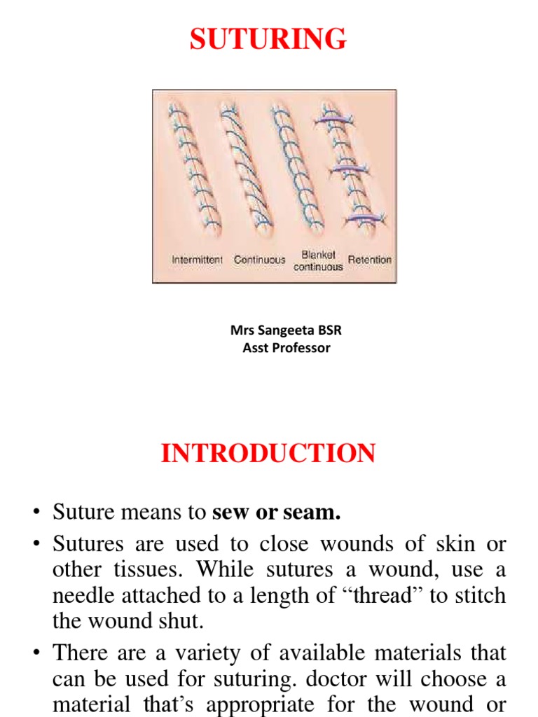 Suturing and Suture Materials | PDF | Surgical Suture | Medicine