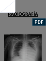 Copia de imagenologia caso ALVARADO.pptx