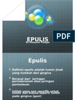 Dokumen - Tips Epulis-Pptpptx