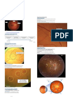 Funduscopy of Retinal Pathologies PDF