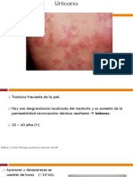 URTICARIA