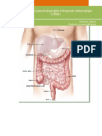 La Cholangio-Pancreatographie Retrograde Endoscopique