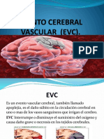 EVENTO CEREBRAL VASCULAR  (EVC).pptx