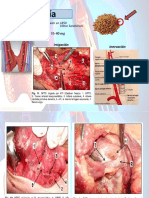 Anatomía de La Glándulas Paratiroides