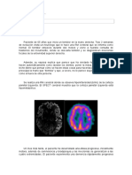 TRABAJO NEUROL.1