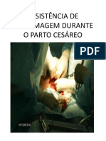 Assistência Ao Parto Cesáreo