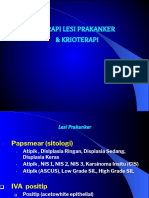 6.terapi Lesi Prakanker & Cryo