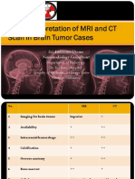 Basic Interpretation of MRI and CT Scan in Brain Tumor Cases