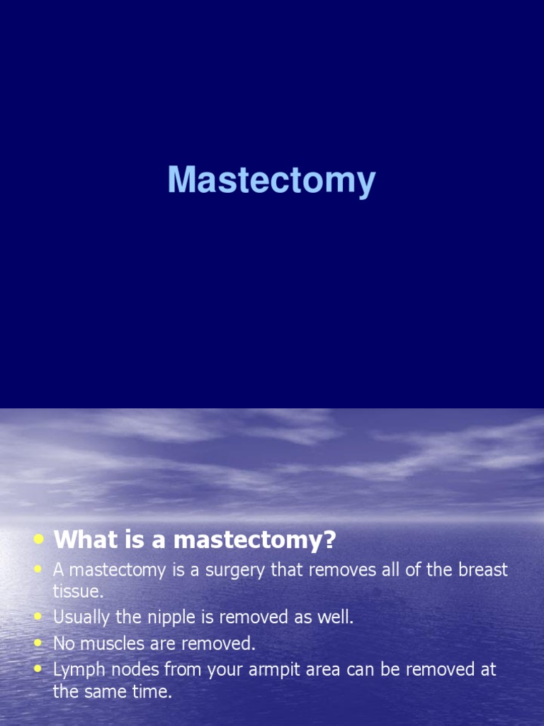 Fmd Navigating The Emotional Physical Aspects Of Preventive Mastectomy - cia2gab