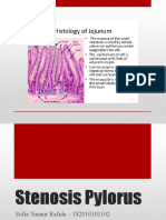 Stenosis Pylorus