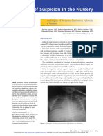 An Enigma of Recurrent Extubation Failure in A Neonate.