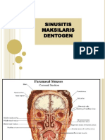 SINUSITIS