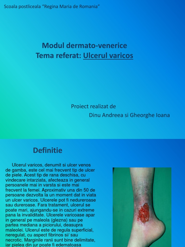 Exterior de tratare varicose - Varicose eczema shin tratament medicamentos