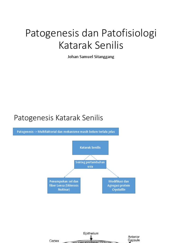 Patogenesis Katarak Senilis dan Patofisiologi | PDF