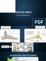 Fraktur Ankle