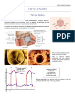 Valvulopatías